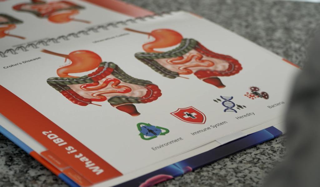 Vivre avec la maladie de Crohn: le combat quotidien de Xavier