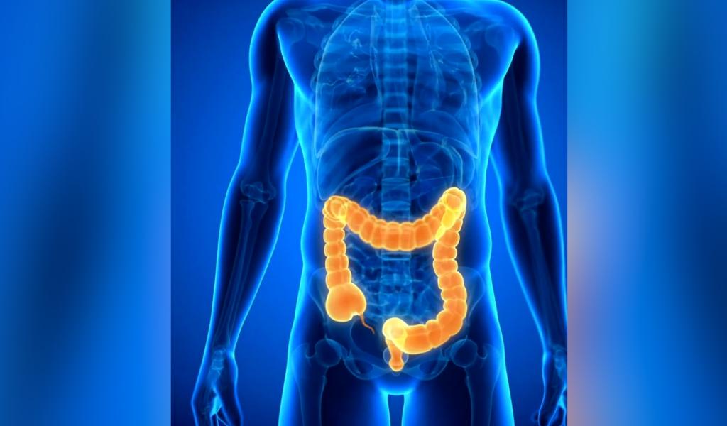 Cancer colorectal : un test gratuit pour les 50-74 ans