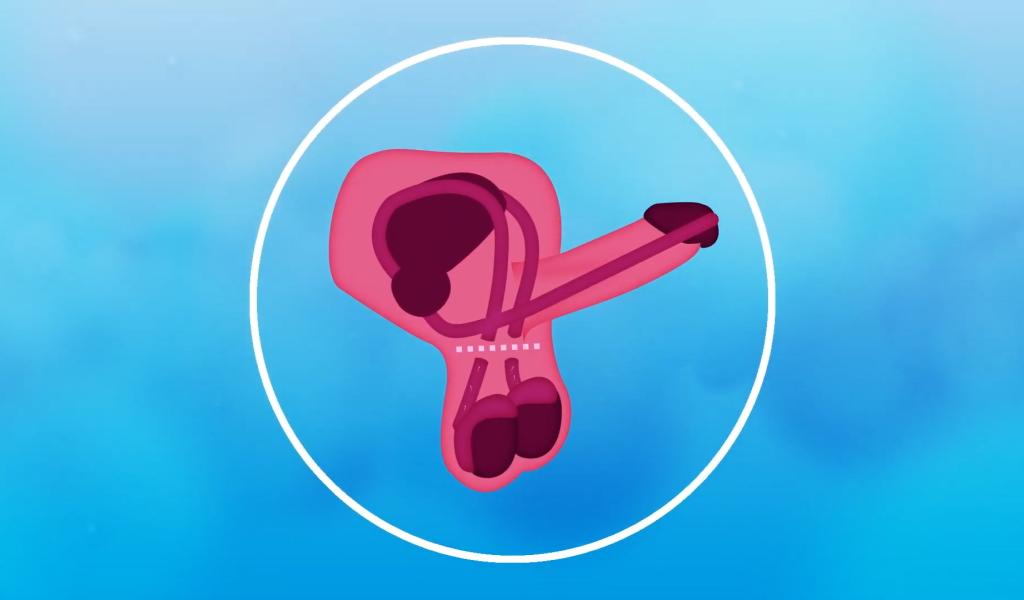 La vasectomie séduit de plus en plus d’hommes en Belgique