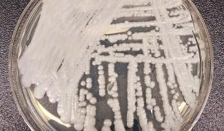 Obligation de signalement du "super-champignon" en Belgique