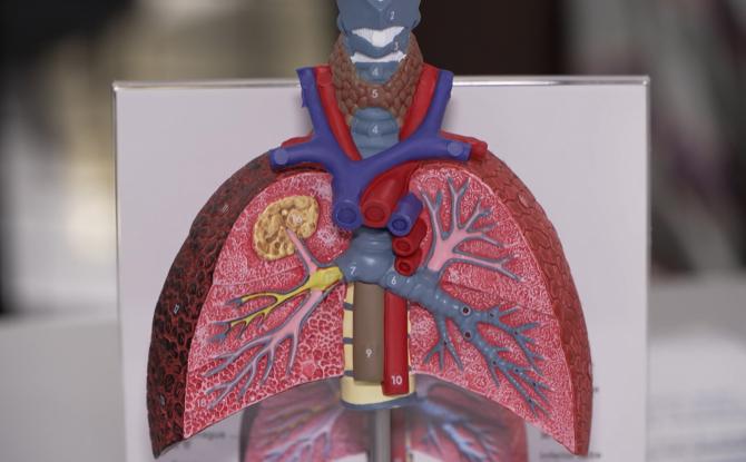 Le Grand hôpital de Charleroi alerte sur les dangers du tabac, de la vape et du cannabis