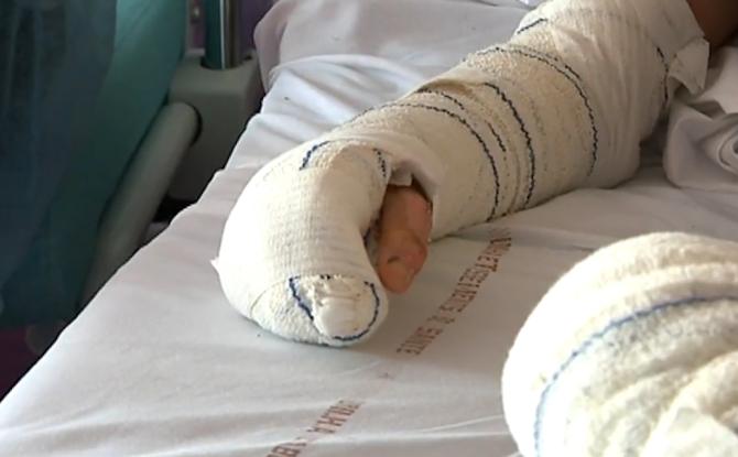 Un blessé suisse pris en charge au centre des grands brûlés du GHDC