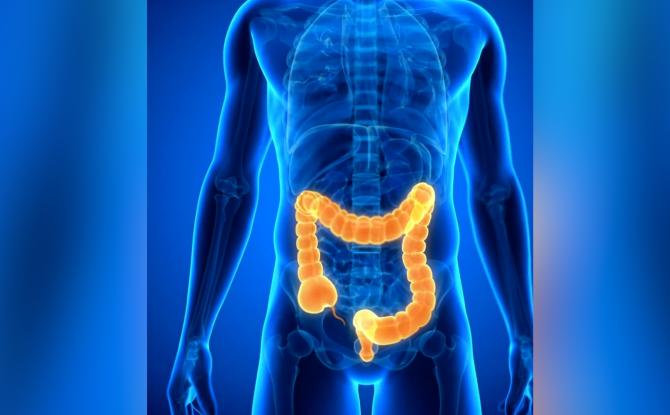 Cancer colorectal : un test gratuit pour les 50-74 ans