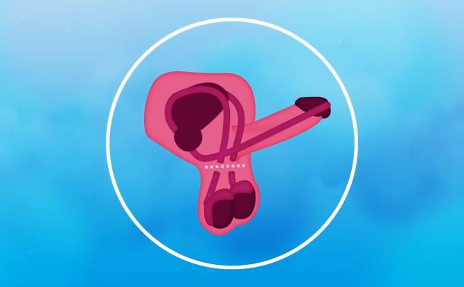 La vasectomie séduit de plus en plus d’hommes en Belgique